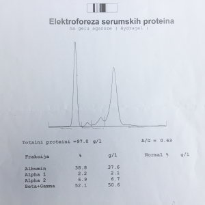 Primjer proteinograma